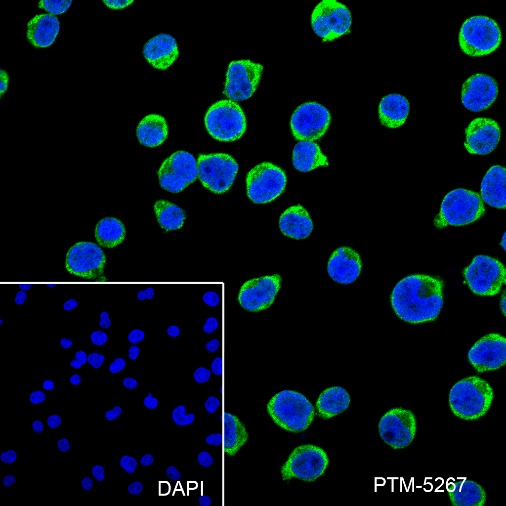 Anti-VPAC2 Rabbit mAb