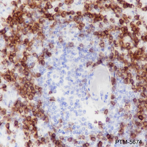 Anti-CD79a Rabbit mAb