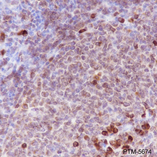 Anti-CD79a Rabbit mAb