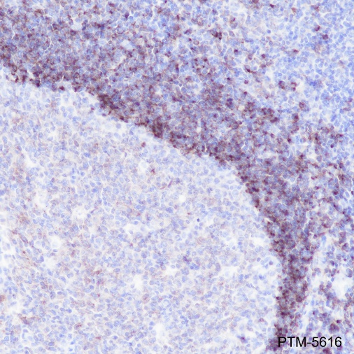 Anti-CD79b Rabbit mAb