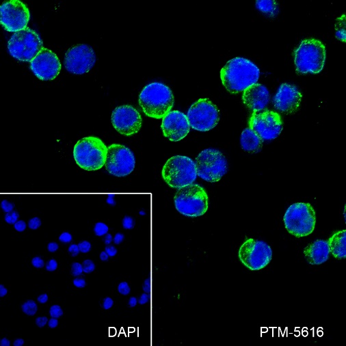 Anti-CD79b Rabbit mAb