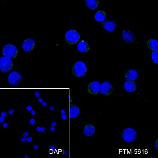 Anti-CD79b Rabbit mAb