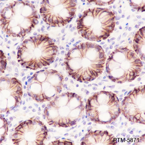 Anti-EpCAM Rabbit mAb