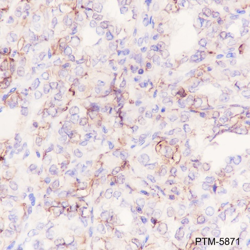 Anti-EpCAM Rabbit mAb