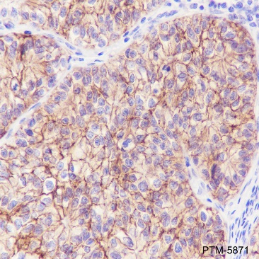 Anti-EpCAM Rabbit mAb