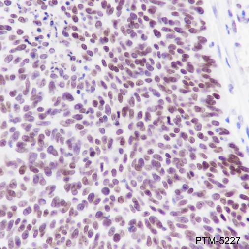 Anti-EZH2 Rabbit mAb