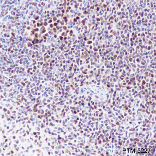 Anti-EZH2 Rabbit mAb