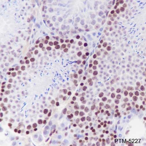 Anti-EZH2 Rabbit mAb