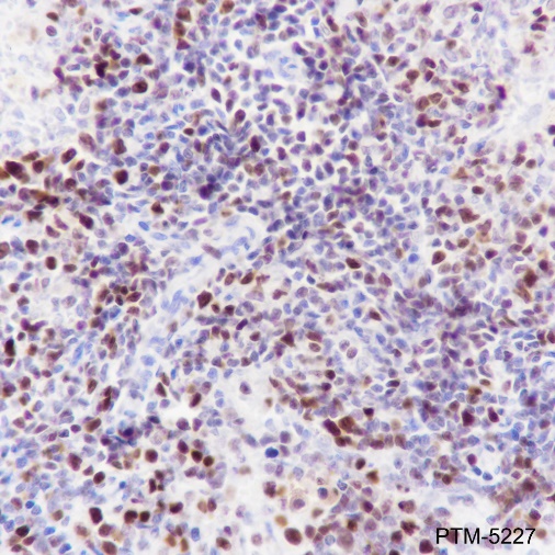 Anti-EZH2 Rabbit mAb