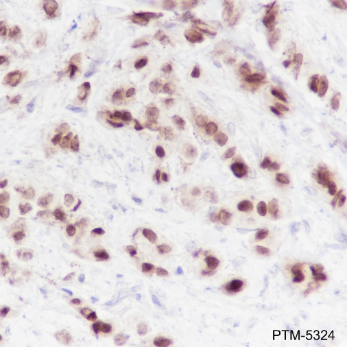 Anti-FOXA1 Rabbit mAb
