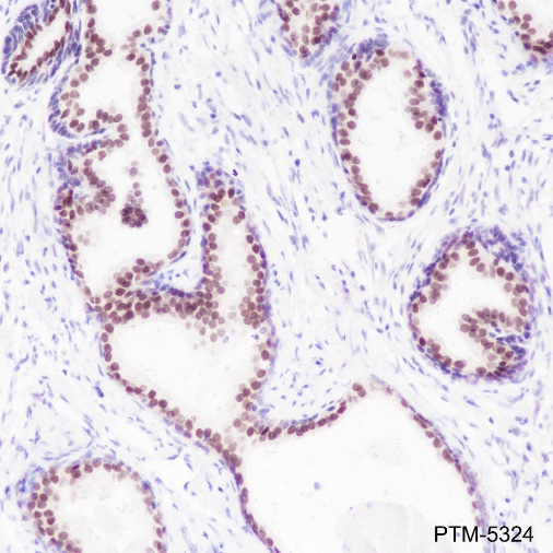 Anti-FOXA1 Rabbit mAb