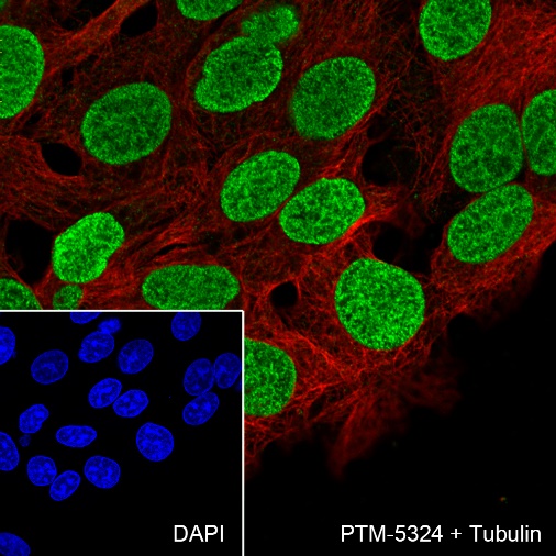 Anti-FOXA1 Rabbit mAb