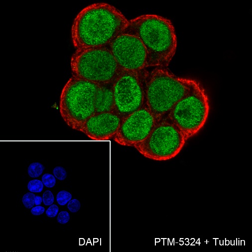 Anti-FOXA1 Rabbit mAb