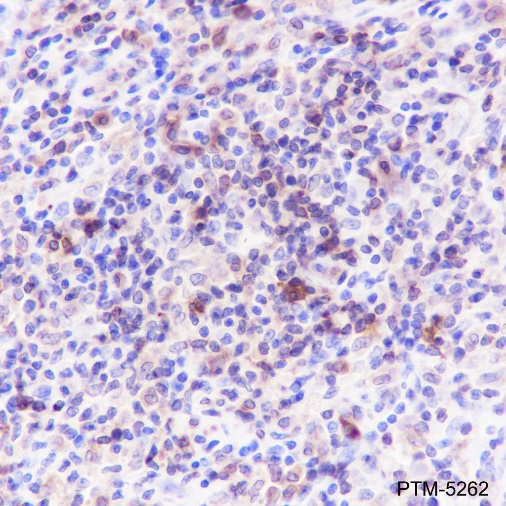 Anti-HLA-DPA1 Rabbit mAb