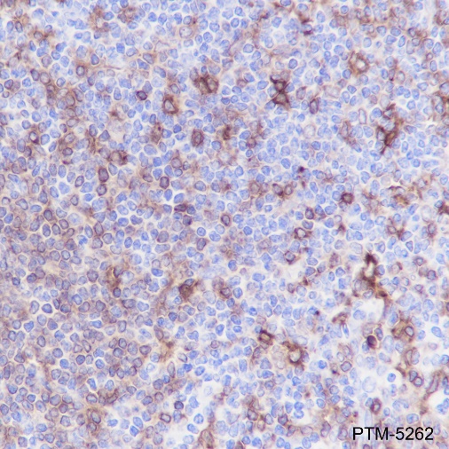 Anti-HLA-DPA1 Rabbit mAb