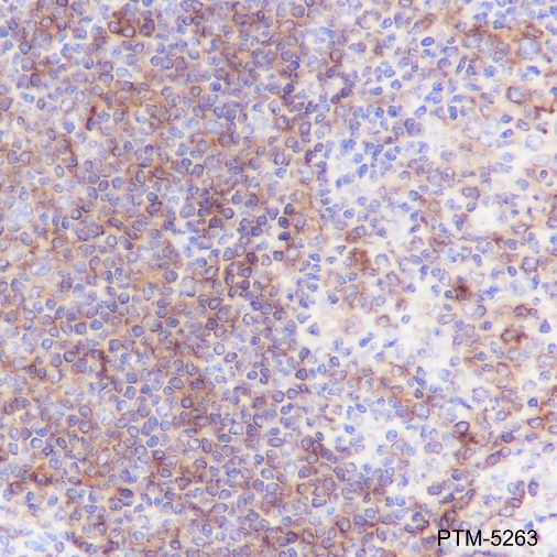 Anti-HLA-DPB1 Rabbit mAb