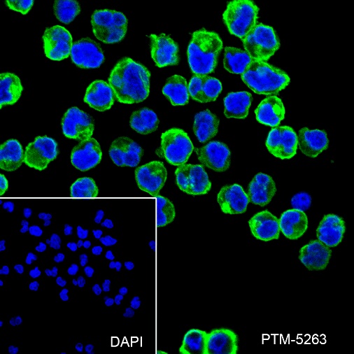 Anti-HLA-DPB1 Rabbit mAb