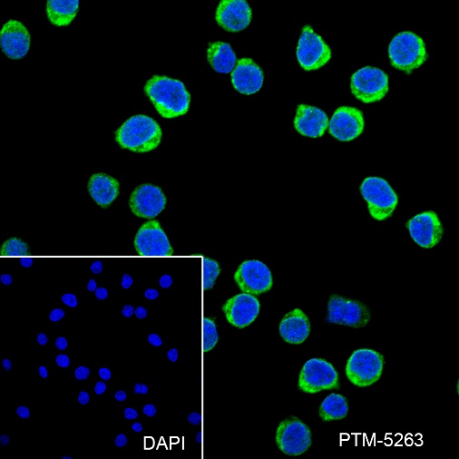 Anti-HLA-DPB1 Rabbit mAb