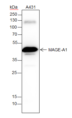 Anti-MAGEA1 Rabbit mAb