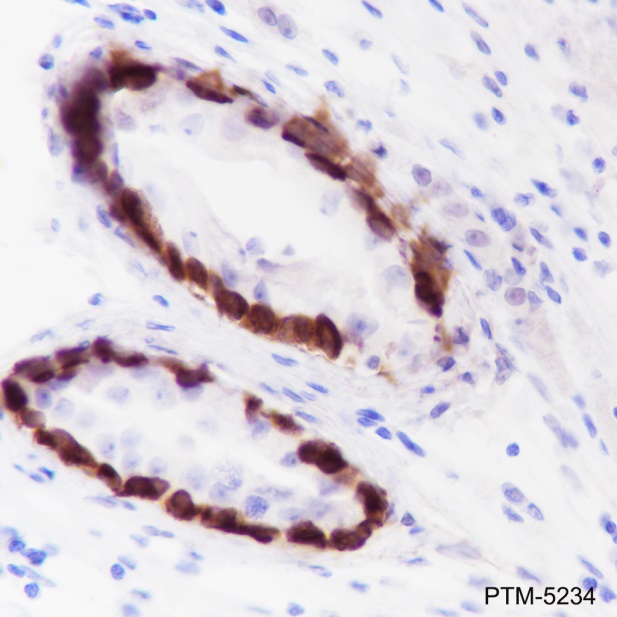 Anti-MAGEA1 Rabbit mAb