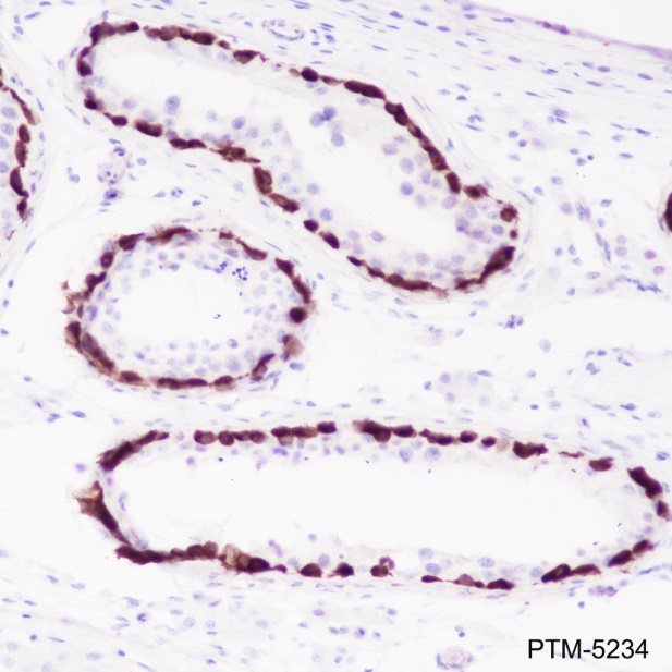 Anti-MAGEA1 Rabbit mAb