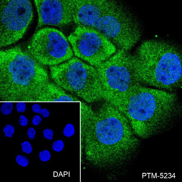 Anti-MAGEA1 Rabbit mAb