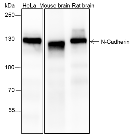 Anti-N-Cadherin Rabbit mAb