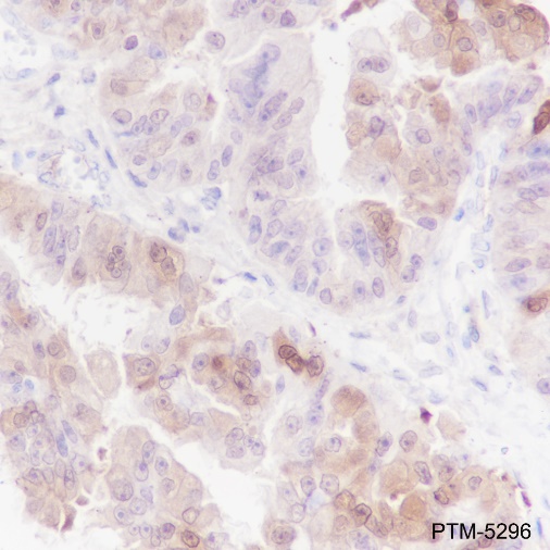 Anti-STAT5a Rabbit mAb