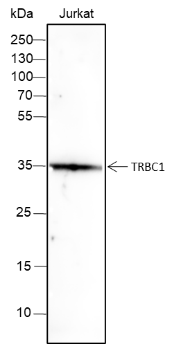 Anti-TRBC1 Rabbit mAb