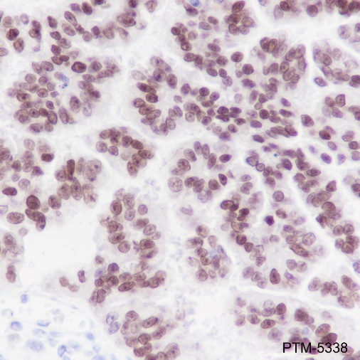 Anti-PAX8 Rabbit mAb