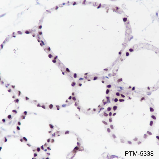 Anti-PAX8 Rabbit mAb
