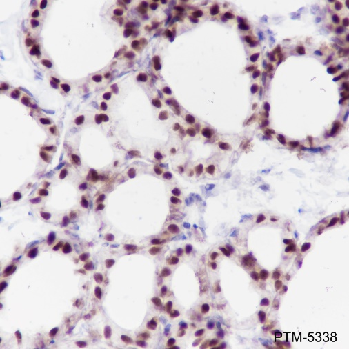 Anti-PAX8 Rabbit mAb
