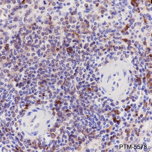 Anti-HLA-DRA Rabbit mAb