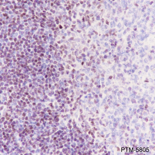 Anti-SATB1 Rabbit mAb