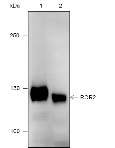 Anti-ROR2 Mouse mAb
