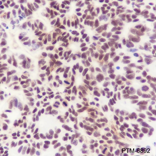 Anti-MBD2 Rabbit mAb
