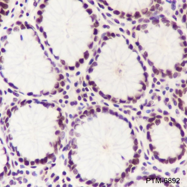 Anti-MBD2 Rabbit mAb