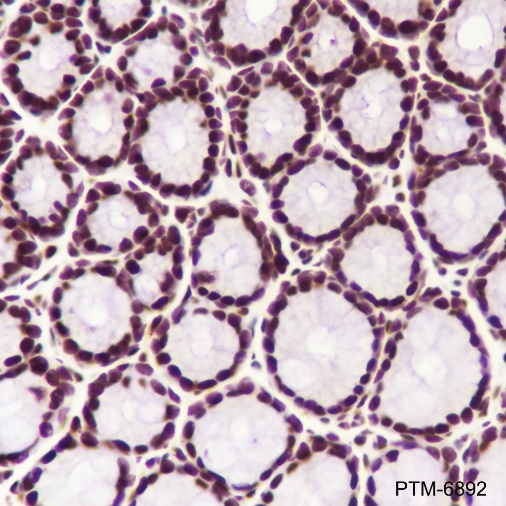 Anti-MBD2 Rabbit mAb