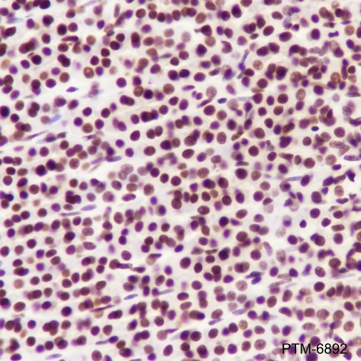 Anti-MBD2 Rabbit mAb