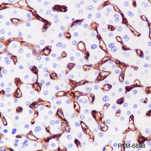 Anti-CD36 Rabbit mAb