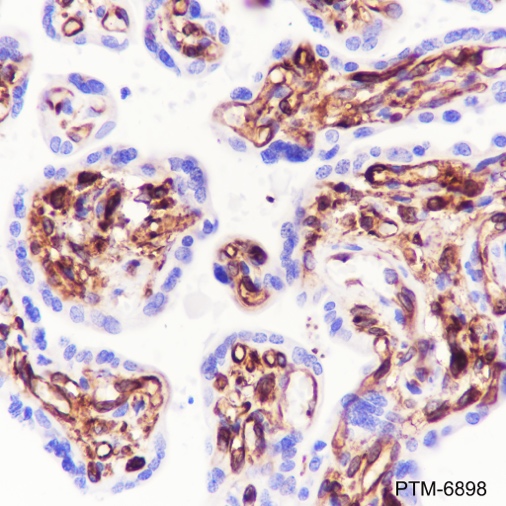 Anti-CD36 Rabbit mAb