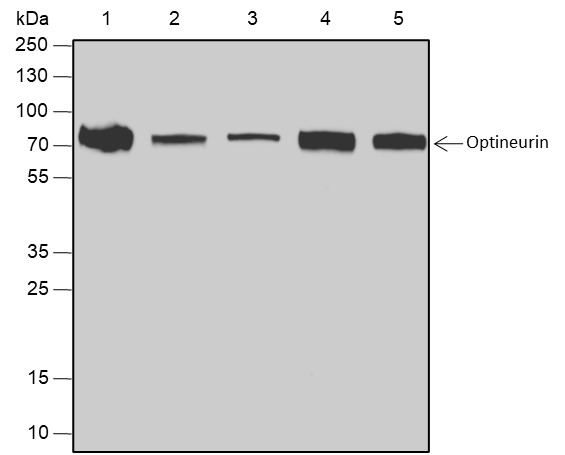 Anti-Optineurin Rabbit mAb