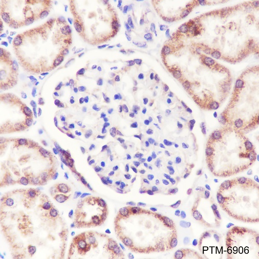 Anti-ACAA2 Rabbit pAb