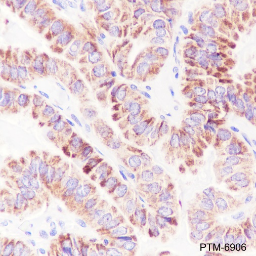 Anti-ACAA2 Rabbit pAb