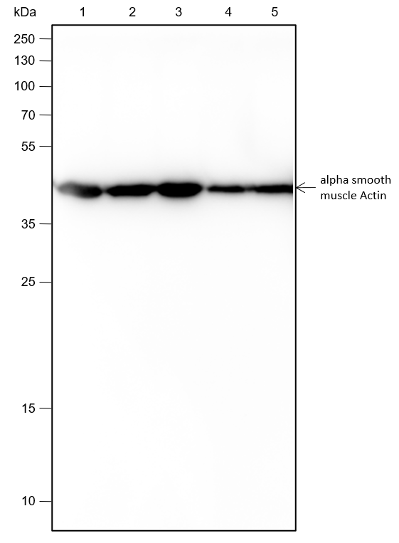 Anti-alpha Smooth Muscle Actin Rabbit mAb