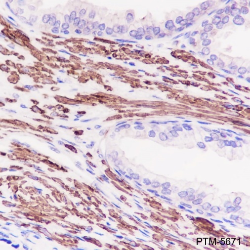 Anti-alpha Smooth Muscle Actin Rabbit mAb