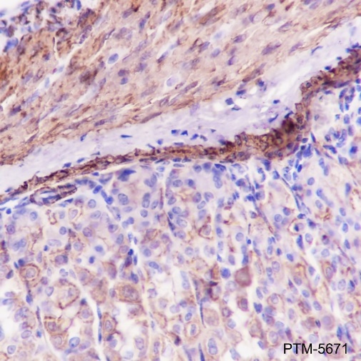 Anti-alpha Smooth Muscle Actin Rabbit mAb