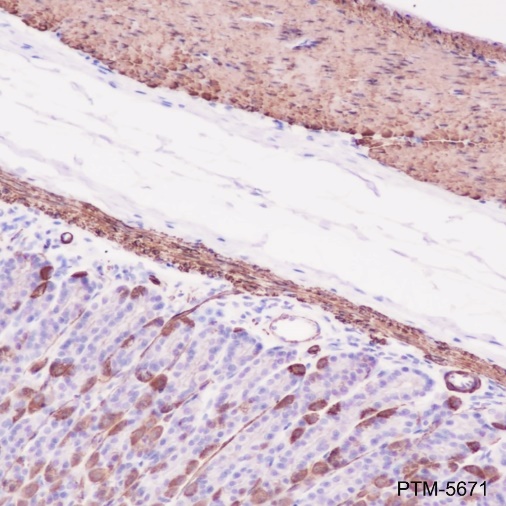 Anti-alpha Smooth Muscle Actin Rabbit mAb