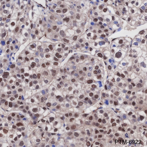 Anti-FTO Rabbit mAb