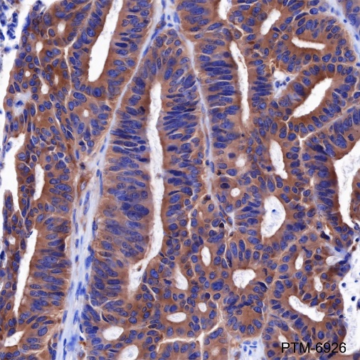 Anti-ROCK2 + ROCK1 Rabbit mAb